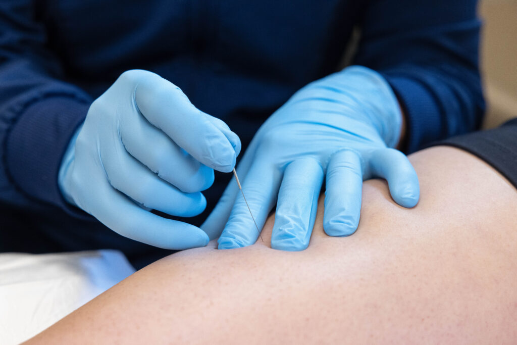 Barbell Physiotherapy Services